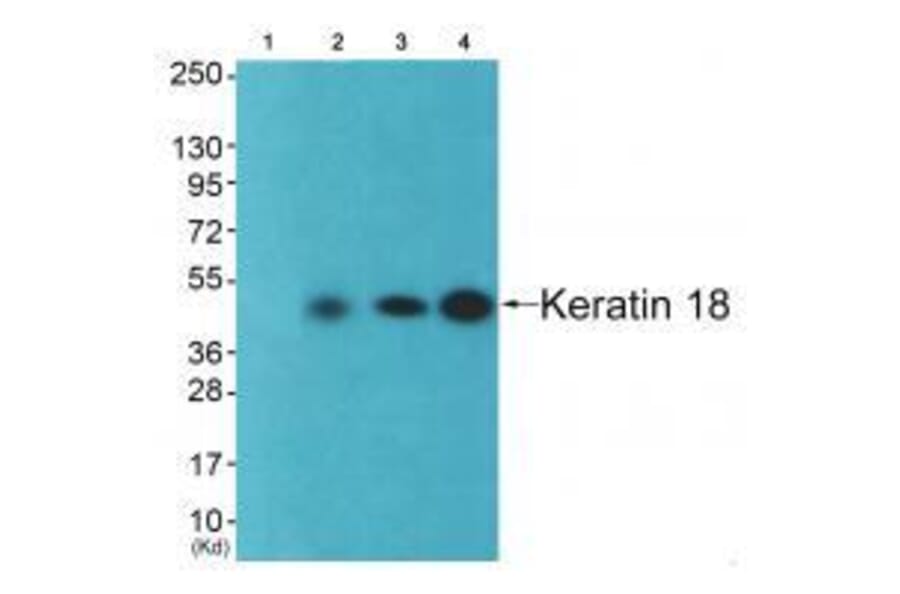 Western blot - Keratin 18 Antibody from Signalway Antibody (33416) - Antibodies.com