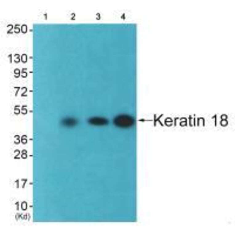 Western blot - Keratin 18 Antibody from Signalway Antibody (33416) - Antibodies.com