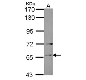 Ladinin 1 antibody from Signalway Antibody (22037) - Antibodies.com