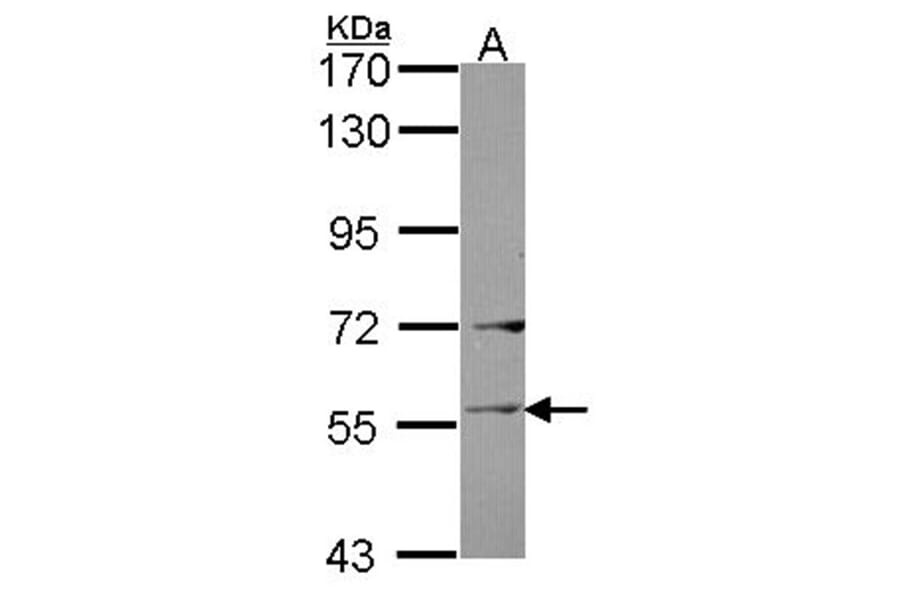 Ladinin 1 antibody from Signalway Antibody (22037) - Antibodies.com