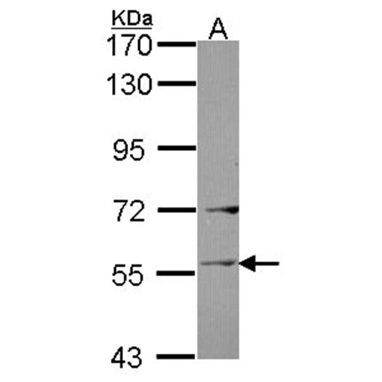 Ladinin 1 antibody from Signalway Antibody (22037) - Antibodies.com