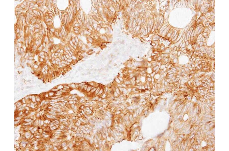 Immunohistochemistry - Ladinin 1 antibody from Signalway Antibody (22037) - Antibodies.com