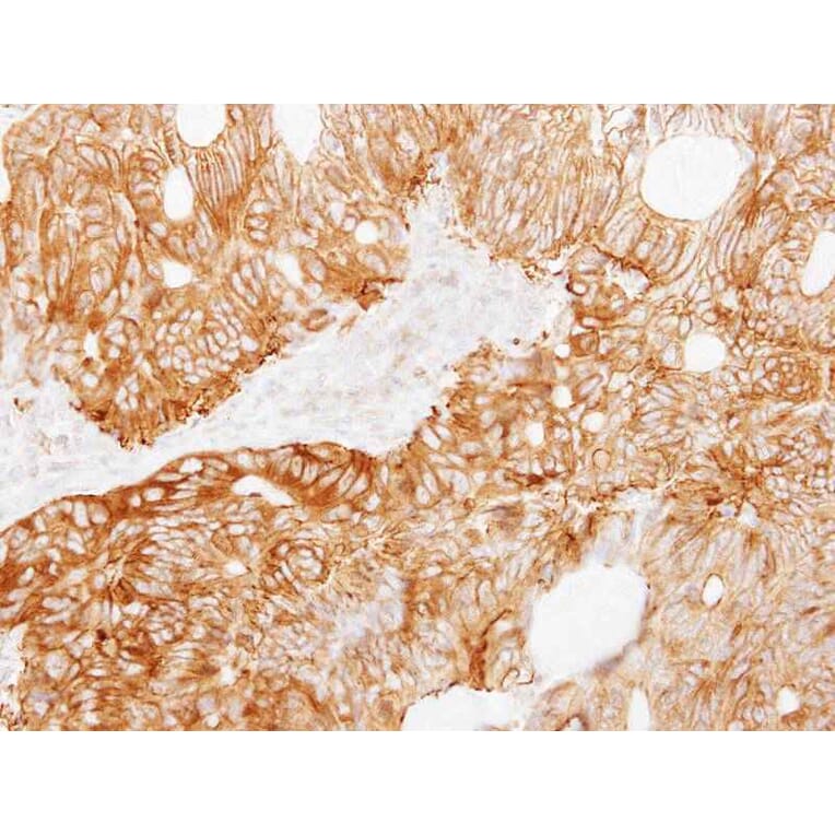 Immunohistochemistry - Ladinin 1 antibody from Signalway Antibody (22037) - Antibodies.com