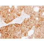 Immunohistochemistry - Ladinin 1 antibody from Signalway Antibody (22037) - Antibodies.com