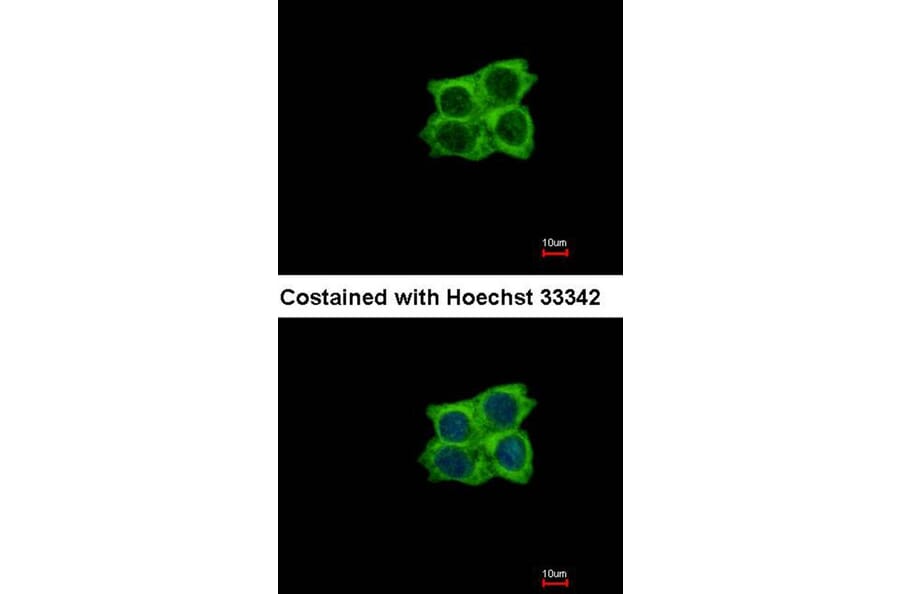 Immunofluorescence - Ladinin 1 antibody from Signalway Antibody (22037) - Antibodies.com