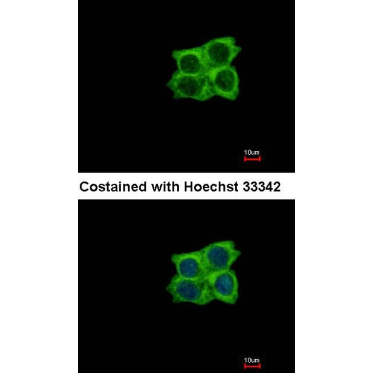 Immunofluorescence - Ladinin 1 antibody from Signalway Antibody (22037) - Antibodies.com