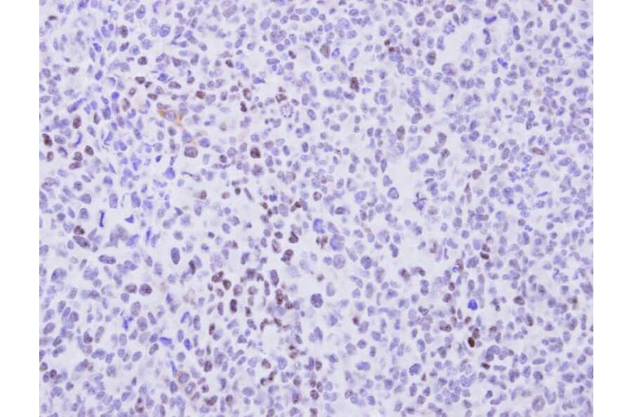 Immunohistochemistry - cyclin T2 antibody from Signalway Antibody (22098) - Antibodies.com
