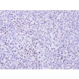 Immunohistochemistry - cyclin T2 antibody from Signalway Antibody (22098) - Antibodies.com