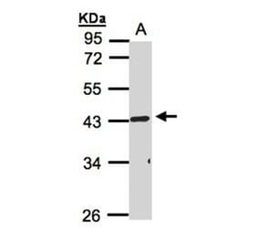 TNFRSF19L antibody from Signalway Antibody (22185) - Antibodies.com