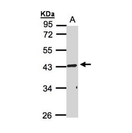 TNFRSF19L antibody from Signalway Antibody (22185) - Antibodies.com