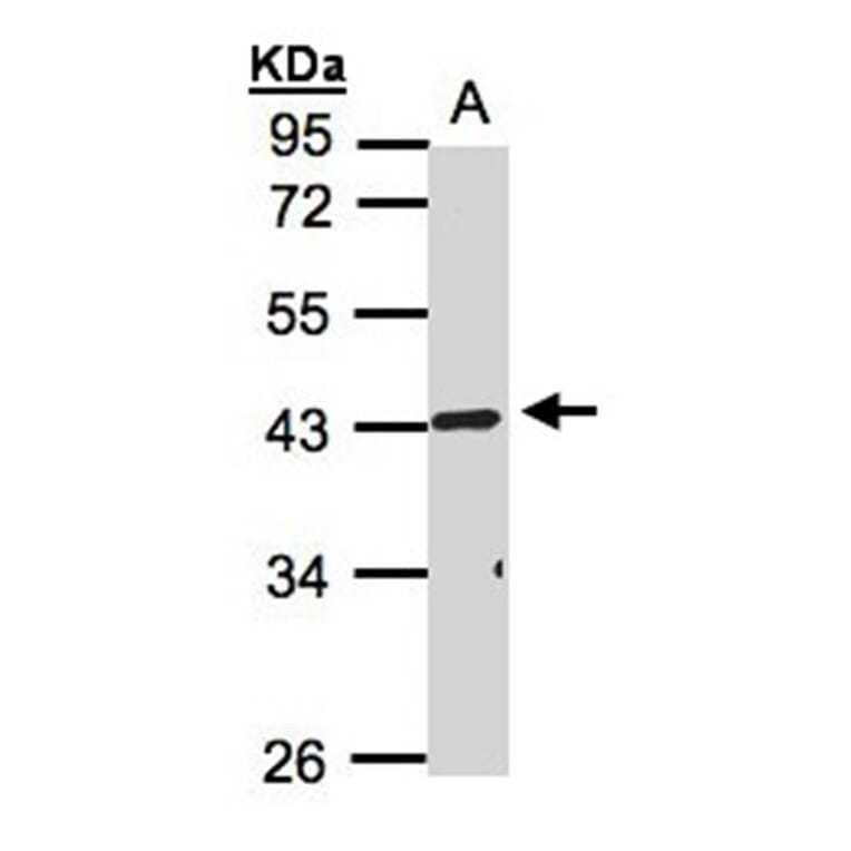 TNFRSF19L antibody from Signalway Antibody (22185) - Antibodies.com