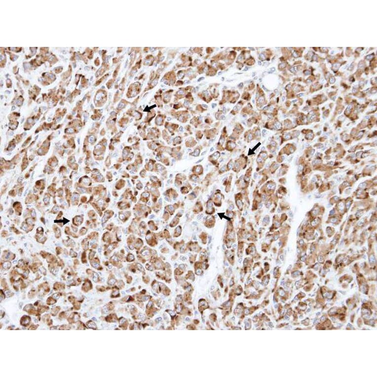 Immunohistochemistry - TNFRSF19L antibody from Signalway Antibody (22185) - Antibodies.com