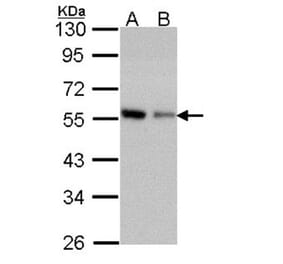 Coronin 3 antibody from Signalway Antibody (22191) - Antibodies.com