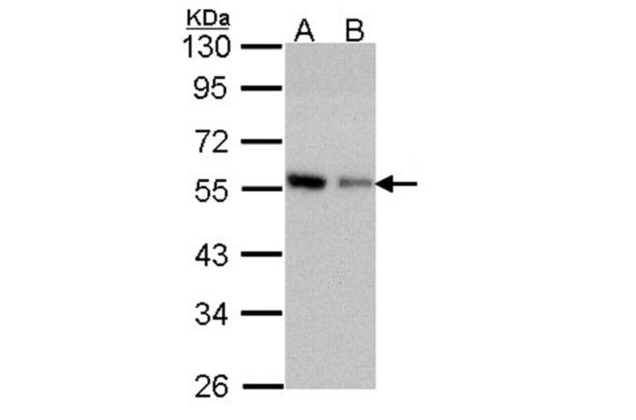 Coronin 3 antibody from Signalway Antibody (22191) - Antibodies.com