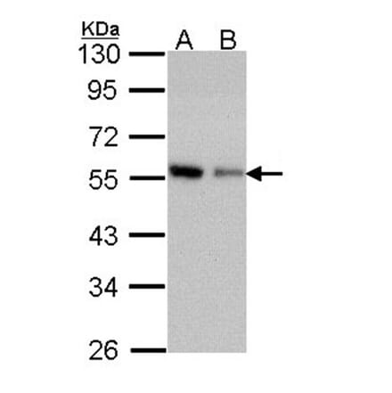 Coronin 3 antibody from Signalway Antibody (22191) - Antibodies.com