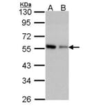 Coronin 3 antibody from Signalway Antibody (22191) - Antibodies.com