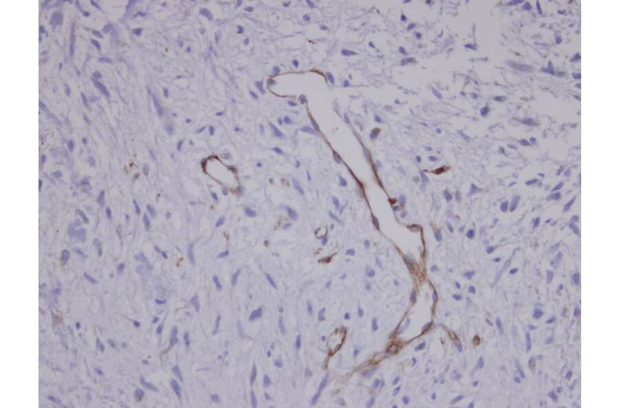 Immunohistochemistry - Coronin 3 antibody from Signalway Antibody (22191) - Antibodies.com
