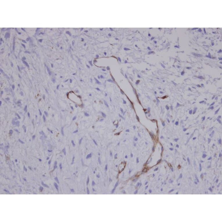 Immunohistochemistry - Coronin 3 antibody from Signalway Antibody (22191) - Antibodies.com