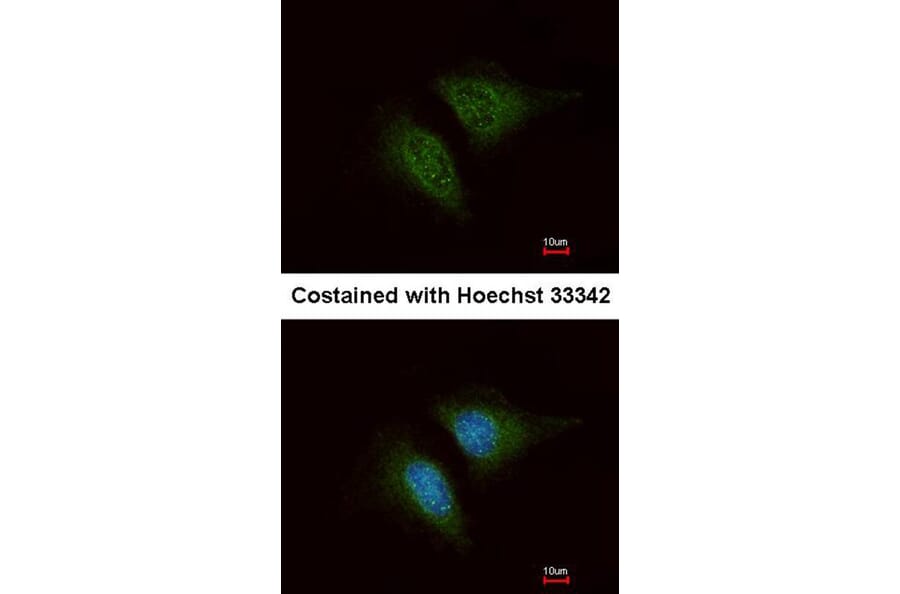Immunofluorescence - Coronin 3 antibody from Signalway Antibody (22191) - Antibodies.com