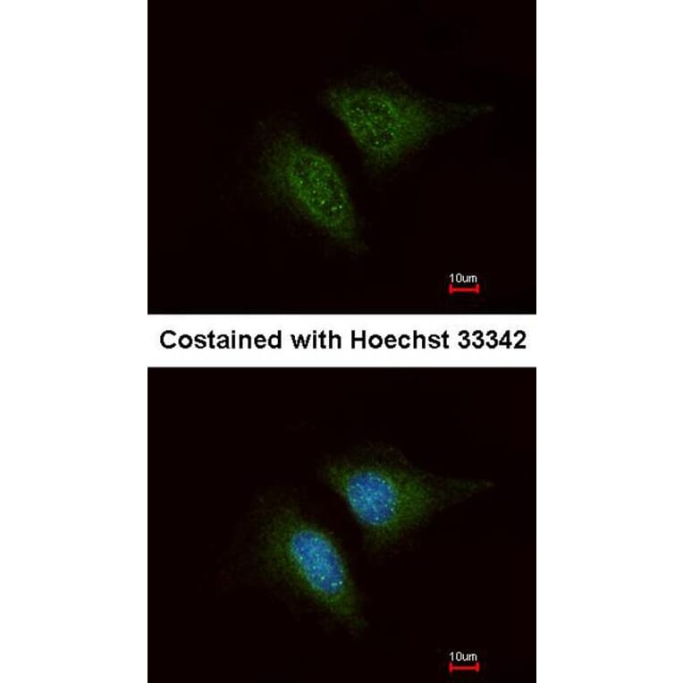 Immunofluorescence - Coronin 3 antibody from Signalway Antibody (22191) - Antibodies.com