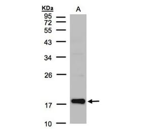 Cofilin 2 antibody from Signalway Antibody (22459) - Antibodies.com