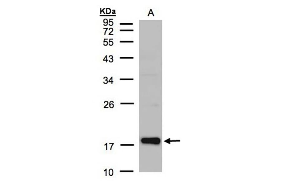 Cofilin 2 antibody from Signalway Antibody (22459) - Antibodies.com