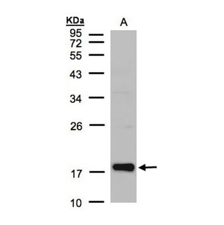 Cofilin 2 antibody from Signalway Antibody (22459) - Antibodies.com