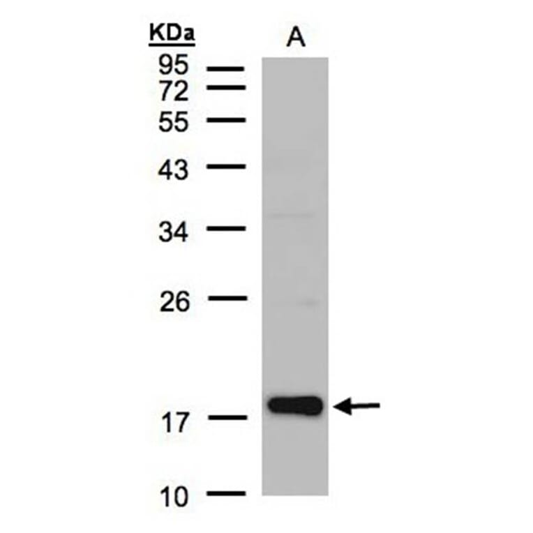 Cofilin 2 antibody from Signalway Antibody (22459) - Antibodies.com