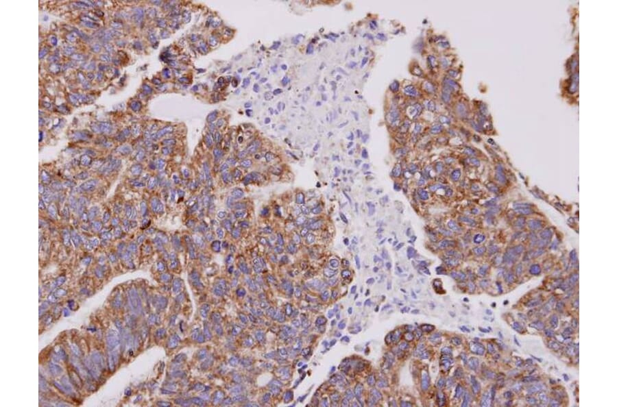 Immunohistochemistry - Cofilin 2 antibody from Signalway Antibody (22459) - Antibodies.com
