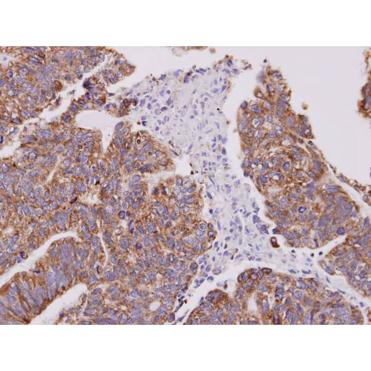 Immunohistochemistry - Cofilin 2 antibody from Signalway Antibody (22459) - Antibodies.com