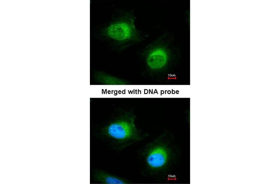 Immunofluorescence - Cofilin 2 antibody from Signalway Antibody (22459) - Antibodies.com