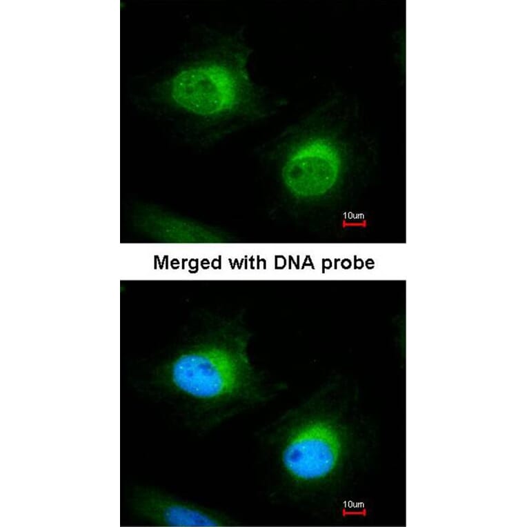 Immunofluorescence - Cofilin 2 antibody from Signalway Antibody (22459) - Antibodies.com