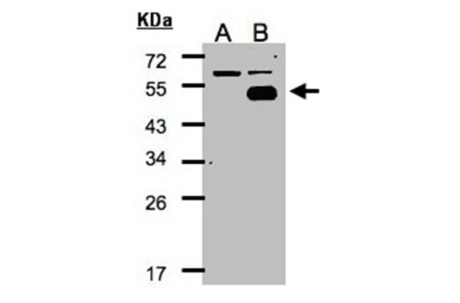 Western blot - COUP-TFI antibody from Signalway Antibody (22640) - Antibodies.com