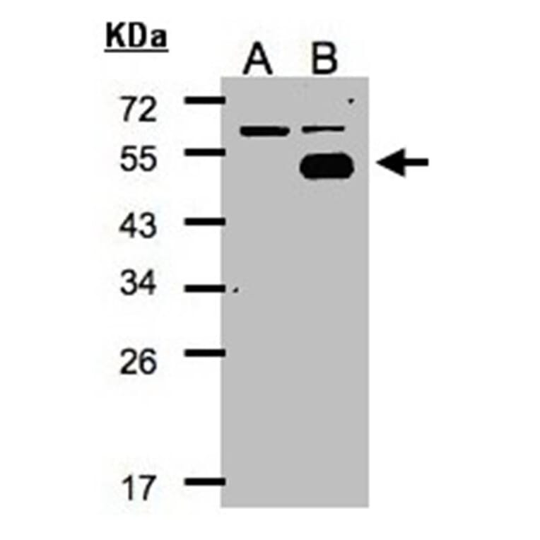 Western blot - COUP-TFI antibody from Signalway Antibody (22640) - Antibodies.com