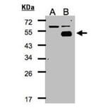 Western blot - COUP-TFI antibody from Signalway Antibody (22640) - Antibodies.com