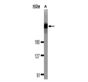 DOCK 180 antibody from Signalway Antibody (22915) - Antibodies.com