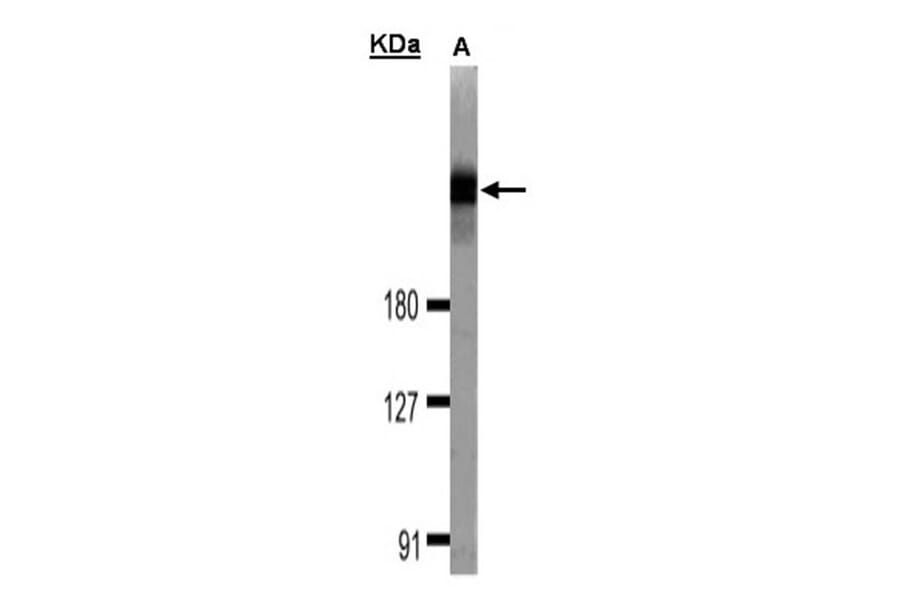 DOCK 180 antibody from Signalway Antibody (22915) - Antibodies.com
