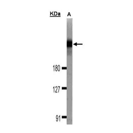 DOCK 180 antibody from Signalway Antibody (22915) - Antibodies.com