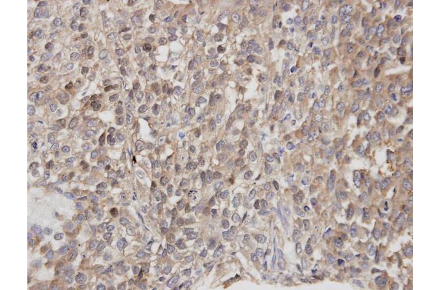 Immunohistochemistry - DOCK 180 antibody from Signalway Antibody (22915) - Antibodies.com