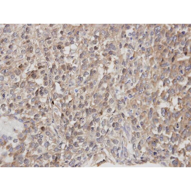 Immunohistochemistry - DOCK 180 antibody from Signalway Antibody (22915) - Antibodies.com
