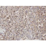 Immunohistochemistry - DOCK 180 antibody from Signalway Antibody (22915) - Antibodies.com