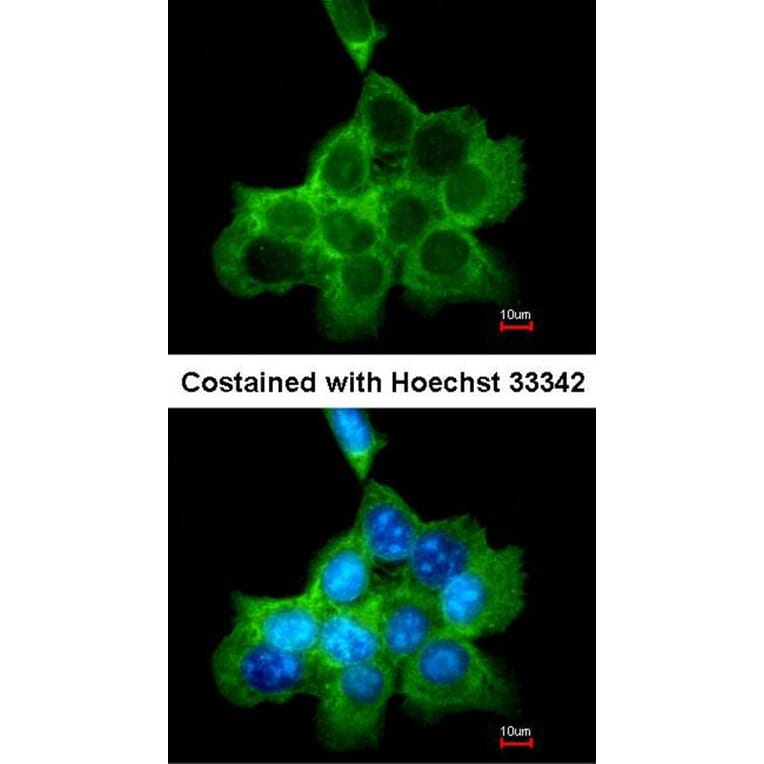 Immunofluorescence - DOCK 180 antibody from Signalway Antibody (22915) - Antibodies.com