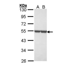 enolase 1 antibody from Signalway Antibody (22990) - Antibodies.com