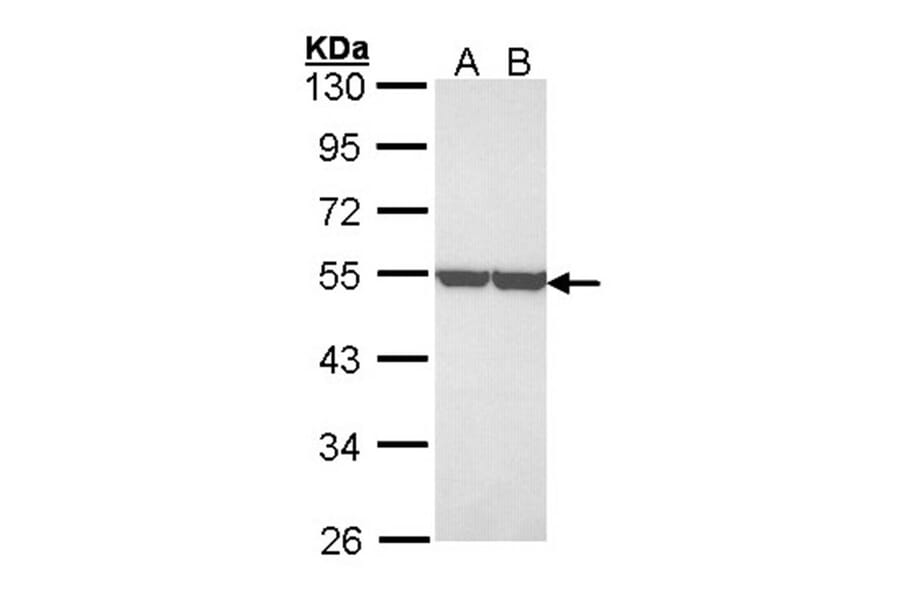 enolase 1 antibody from Signalway Antibody (22990) - Antibodies.com