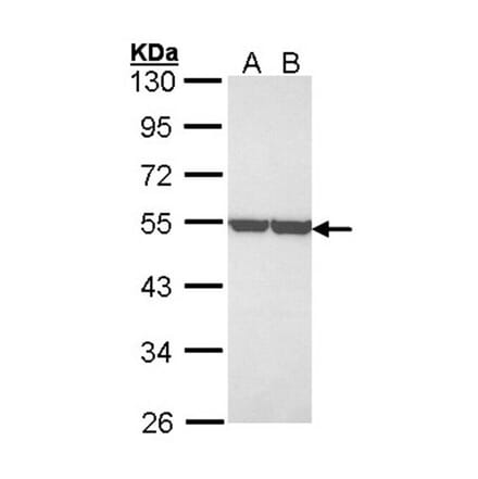enolase 1 antibody from Signalway Antibody (22990) - Antibodies.com