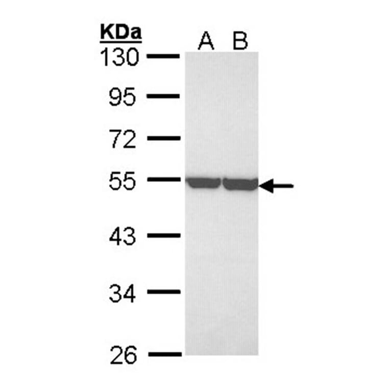 enolase 1 antibody from Signalway Antibody (22990) - Antibodies.com