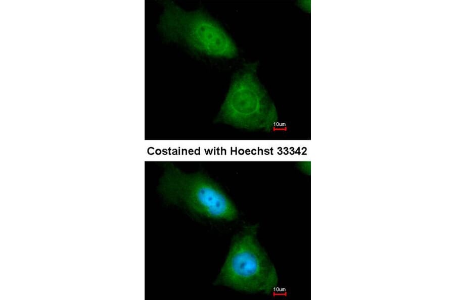 Immunofluorescence - enolase 1 antibody from Signalway Antibody (22990) - Antibodies.com