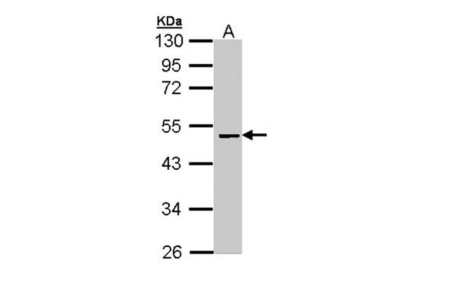 AntiFactor X Antibody (A34784)