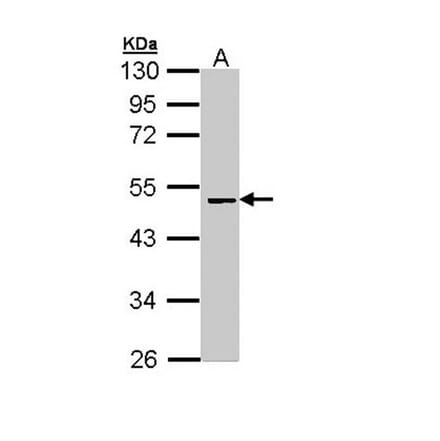 Factor X antibody from Signalway Antibody (22993) - Antibodies.com