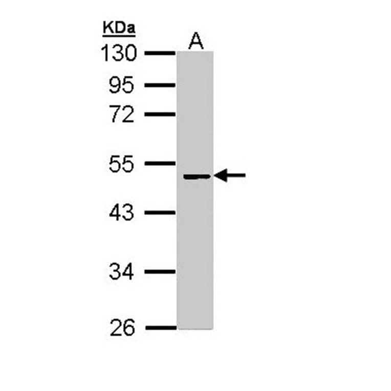 Factor X antibody from Signalway Antibody (22993) - Antibodies.com